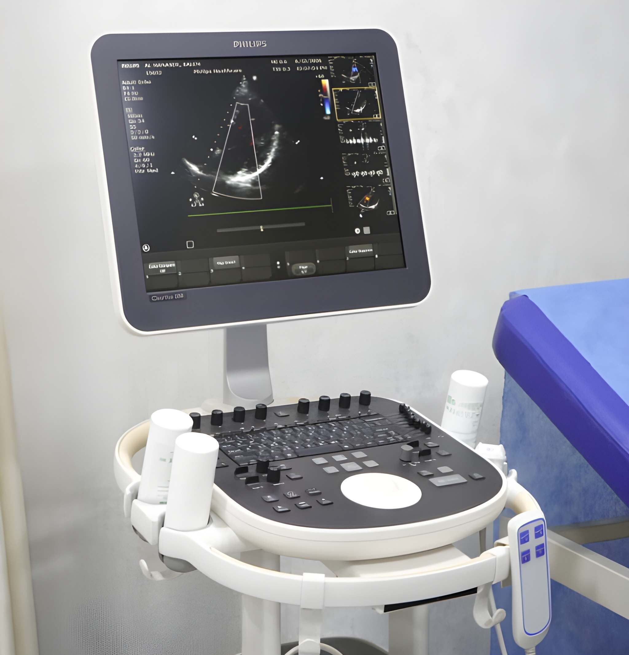 Specialized Cardiac Testing